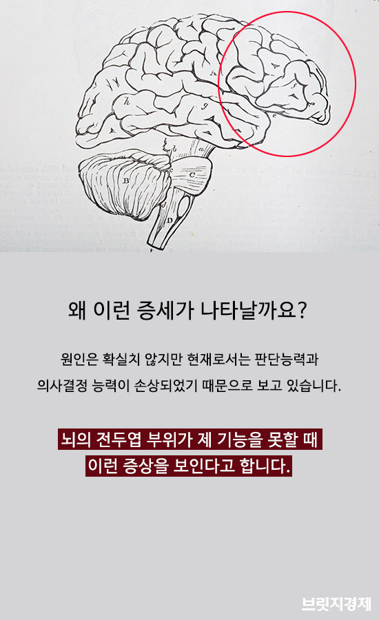 저장강박증10