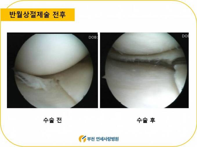 171123_추위에 급증하는 