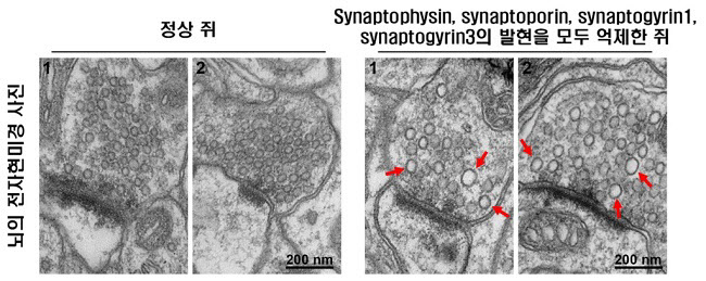 뇌 속 신경전말물질 주머니 크기 조절인자 최초 발견